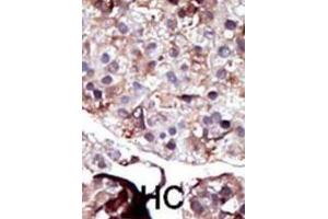 Immunohistochemistry (IHC) image for anti-Sphingosine Kinase 2 (SPHK2) antibody (ABIN3003068) (SPHK2 Antikörper)