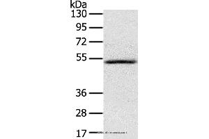 Western blot analysis of Human normal liver tissue, using IL17RB Polyclonal Antibody at dilution of 1:200