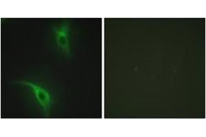 Immunofluorescence analysis of HeLa cells, using CKS1 Antibody. (CKS1 Antikörper  (AA 10-59))