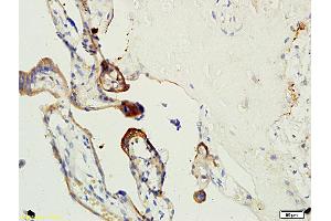 Formalin-fixed and paraffin embedded human placenta tissue labeled with Anti-Factor XIII Polyclonal Antibody, Unconjugated (ABIN731738) at 1:200 followed by conjugation to the secondary antibody, (SP-0023), and DAB staining (Factor XIII Antikörper  (AA 331-732))