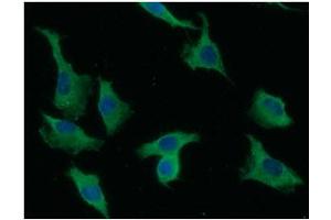 ICC/IF analysis of LYVE-1 in A549 cells line, stained with DAPI (Blue) for nucleus staining and monoclonal anti-human LYVE-1 antibody (1:100) with goat anti-mouse IgG-Alexa fluor 488 conjugate (Green).