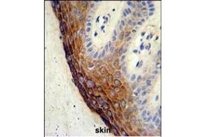 Formalin-fixed and paraffin-embedded human skin tissue reacted with ECE-1 Antibody (C-term), which was peroxidase-conjugated to the secondary antibody, followed by DAB staining. (ECE1 Antikörper  (AA 528-556))