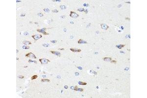 Immunohistochemistry of paraffin-embedded Rat brain using PIK3CA Polyclonal Antibody at dilution of 1:100 (40x lens). (PIK3CA Antikörper)