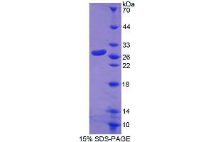 SDS-PAGE (SDS) image for rho Family GTPase 1 (RND1) (AA 1-229) protein (His tag) (ABIN4988871)