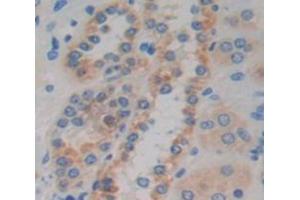 Used in DAB staining on fromalin fixed paraffin- embedded Kidney tissue (CCDC60 Antikörper  (AA 388-520))
