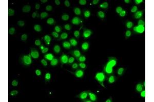 Immunofluorescence analysis of HeLa cells using GABARAP antibody (ABIN6134237, ABIN6140873, ABIN6140876 and ABIN6217999). (GABARAP Antikörper  (AA 1-100))