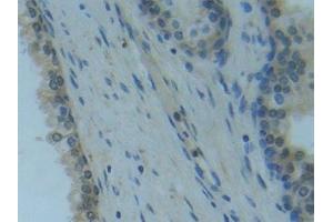 Detection of Raftlin in Human Prostate Tissue using Polyclonal Antibody to Raft Linking Protein (Raftlin) (RFTN1 Antikörper  (AA 288-520))