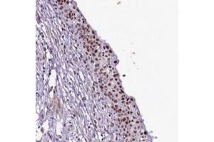 Immunohistochemical staining of human urinary bladder with SAMD10 polyclonal antibody  shows strong nuclear positivity in urothelial cells. (SAMD10 Antikörper)