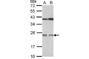 WB Image Sample (30 ug of whole cell lysate) A: 293T B: A431 12% SDS PAGE antibody diluted at 1:1000