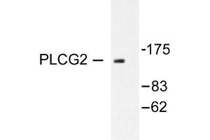 Image no. 1 for anti-Phospholipase C gamma 2 (PLCG2) antibody (ABIN271905)