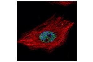 Immunofluorescence (IF) image for anti-TAR DNA Binding Protein (TARDBP) antibody (ABIN2854799)