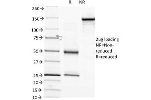 SDS-PAGE Analysis of Purified anti-Biotin Mouse Monoclonal antibody (Hyb-8). (Biotin Antikörper)