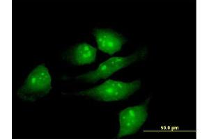 Immunofluorescence of purified MaxPab antibody to METTL2 on HeLa cell. (METTL2B Antikörper  (AA 1-313))