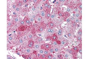 Anti-SUPT16H antibody IHC of human liver. (SUPT16H Antikörper)