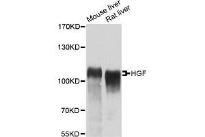Western blot analysis of extracts of various cell lines, using HGF antibody. (HGF Antikörper)
