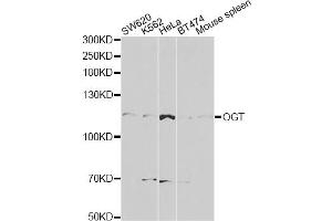 Western blot analysis of extracts of various cell lines, using OGT antibody (ABIN5998410) at 1/1000 dilution. (OGT Antikörper)