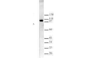 Western Blotting (WB) image for anti-Lysine (K)-Specific Demethylase 1A (KDM1A) antibody (ABIN577699) (LSD1 Antikörper)