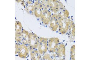 Immunohistochemistry of paraffin-embedded human gastric using DYNC1I1 antibody at dilution of 1:100 (x40 lens). (DYNC1I1 Antikörper)
