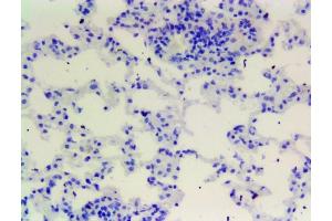 Immunohistochemistry (IHC) image for anti-Ionized Calcium-binding Adapter Molecule 1 (IBA1) (C-Term) antibody (ABIN184738)