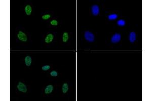 Immunofluorescence of Rabbit Anti-Histone H3 [p Thr11, p Ser10] Antibody. (Histone 3 Antikörper  (pSer10, pThr11))