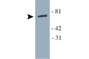 Western blot analysis of YAP1 using YAP1 polyclonal antibody  in transfected HEK 293 cell lysate. (YAP1 Antikörper)