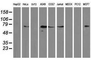 Image no. 2 for anti-Mahogunin, Ring Finger 1 (MGRN1) antibody (ABIN1499459) (Mahogunin RING Finger Protein 1 Antikörper)