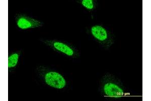 Immunofluorescence of monoclonal antibody to ZNF71 on HeLa cell. (ZNF71 Antikörper  (AA 1-100))