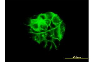 Immunofluorescence (IF) image for anti-Junction Plakoglobin (JUP) (AA 1-745) antibody (ABIN561572)