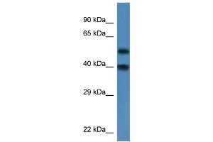 WB Suggested Anti-Nup37 Antibody   Titration: 1. (NUP37 Antikörper  (N-Term))