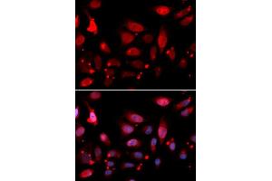Immunofluorescence analysis of U2OS cells using RACGAP1 antibody (ABIN5973044). (RACGAP1 Antikörper)