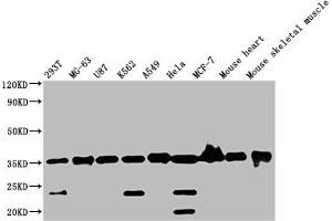 Western Blot Positive WB detected in: Mouse skeletal muscle tissue All lanes: ANKRD23 antibody at 2. (ANKRD23 Antikörper  (AA 1-200))