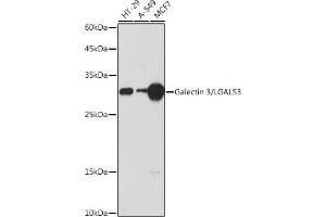 Western blot analysis of extracts of various cell lines, using Galectin 3/Galectin 3/LG antibody (ABIN7267338) at 1:1000 dilution. (Galectin 3 Antikörper  (AA 1-250))