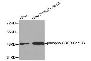 Western blot analysis of extracts from HeLa cells untreated or treated with UV, using Phospho-CREB1-S133 antibody (ABIN2987962). (CREB1 Antikörper  (pSer133))