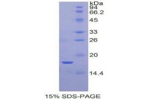 SDS-PAGE (SDS) image for Periostin (POSTN) (AA 97-230) protein (His tag) (ABIN1171087)