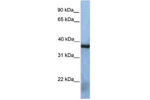 NAT12 antibody used at 1 ug/ml to detect target protein.