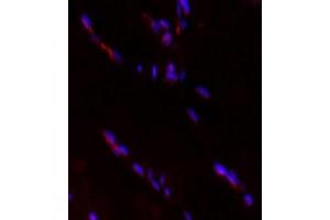 Immunofluorescent analysis of paraformaldehyde-fixed rat skeletal muscle using HECTD1 (ABIN7074186) at dilution of,1: 2000 (HECTD1 Antikörper)
