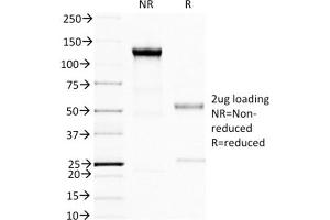 SDS-PAGE Analysis Purified BRCA1 Mouse Monoclonal Antibody (BRCA1/1398). (BRCA1 Antikörper  (AA 445-620))