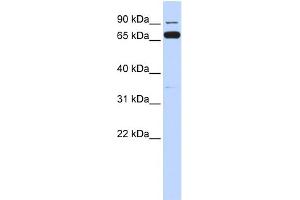 WB Suggested Anti-IKBKB Antibody Titration:  0. (IKBKB Antikörper  (Middle Region))
