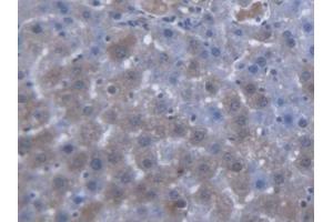 DAB staining on IHC-P; Samples: Rat Liver Tissue (SLC25A20 Antikörper  (AA 1-211))