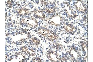 Immunohistochemistry (IHC) image for anti-Arginase, Liver (ARG1) (N-Term) antibody (ABIN2773866) (Liver Arginase Antikörper  (N-Term))
