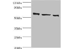 Western blot All lanes: COIL antibody at 3 μg/mL Lane 1: MCF-7 whole cell lysate Lane 2: Hela whole cell lysate Lane 3: HepG2 whole cell lysate Secondary Goat polyclonal to rabbit IgG at 1/10000 dilution Predicted band size: 63 kDa Observed band size: 63 kDa (Coilin Antikörper  (AA 297-576))