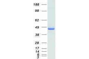 Western Blotting (WB) image for TNF Receptor-Associated Factor 1 (TRAF1) protein (Myc-DYKDDDDK Tag) (ABIN2734111)