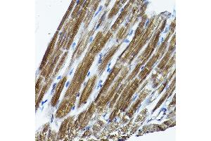 Immunohistochemistry of paraffin-embedded rat heart using ICMT Rabbit pAb (ABIN6128077, ABIN6142129, ABIN6142130 and ABIN6214491) at dilution of 1:200 (40x lens).