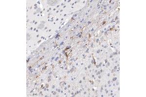 Immunohistochemistry of paraffin embedded mouse brain using ACyclaseI (ABIN7072958) at dilution of 1:650 (300x lens) (ADCY1 Antikörper)