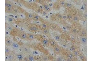 DAB staining on IHC-P; Samples: Human Liver Tissue (SHB Antikörper  (AA 252-507))