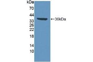 Detection of Recombinant VCP, Human using Polyclonal Antibody to Valosin Containing Protein (VCP) (VCP Antikörper  (AA 125-371))