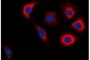 Immunofluorescent analysis of EGFR (pY1016) staining in Jurkat cells. (EGFR Antikörper  (C-Term, pTyr1016))