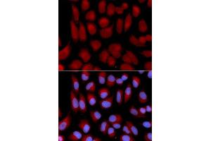 Immunofluorescence (IF) image for anti-Transporter 2, ATP-Binding Cassette, Sub-Family B (MDR/TAP) (TAP2) (AA 430-680) antibody (ABIN3022237)