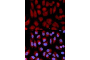 Immunofluorescence analysis of U2OS cell using TAP2 antibody. (TAP2 Antikörper  (AA 430-680))