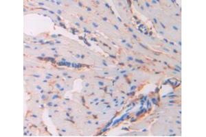 IHC-P analysis of Mouse Heart Tissue, with DAB staining. (CD34 Antikörper  (AA 36-287))